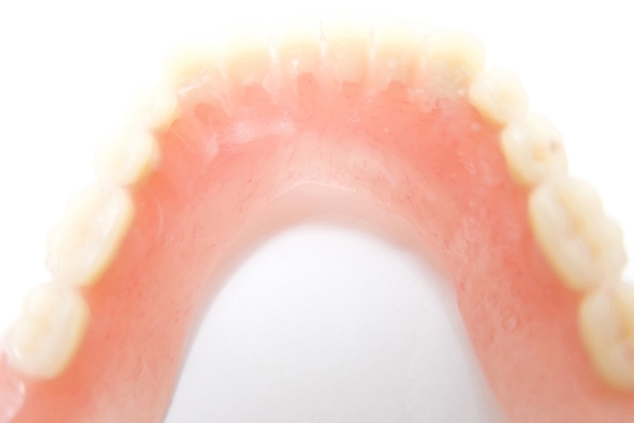 岩見沢市の歯医者、ハタテ歯科医院の入れ歯治療の流れ