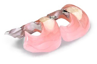 岩見沢市の歯医者、ハタテ歯科医院の料金表