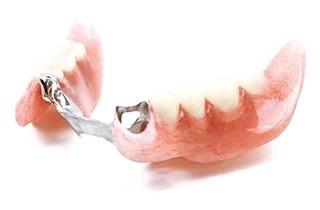 岩見沢市の歯医者、ハタテ歯科医院の料金表