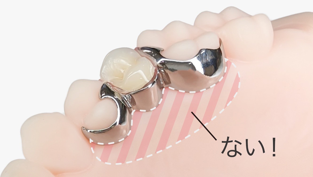 岩見沢市の歯医者、ハタテ歯科医院の料金表